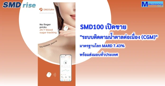 SMD100 เดินหน้าเต็มกำลัง! เปิดจำหน่าย “ระบบติดตามระดับน้ำตาลแบบต่อเนื่อง (CGM)” อย่างเป็นทางการ ยืนยันผลทางคลินิก ค่า MARD เฉลี่ย 7.43% – มาตรฐานระดับโลก พร้อมส่งมอบแล้วทั่วประเทศ