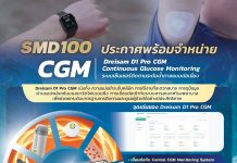 SMD100 พร้อมจำหน่าย Dreisam D1 Pro CGM เซ็นเซอร์วัดน้ำตาลอัจฉริยะรุ่นใหม่